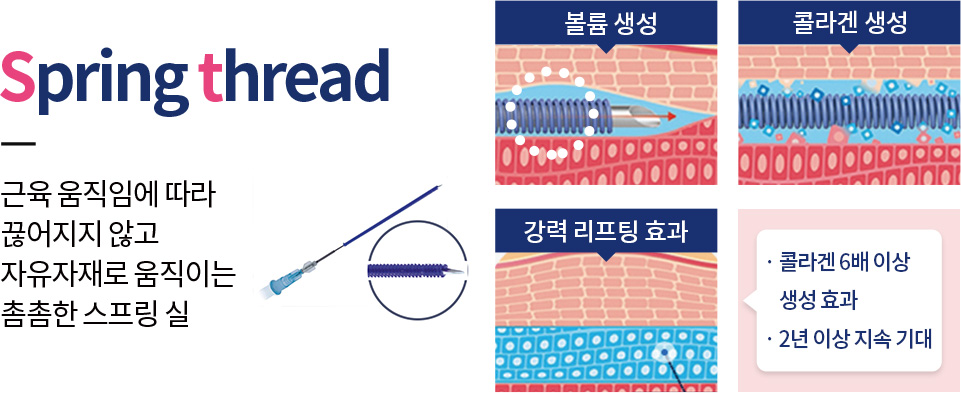근육 움직임에 따라 끊어지지 않고 자유자재로 움직이는 촘촘한 스프링 실 수원피부과-수원역피부과 1mm변화, 자신감을 되찾는 수원피부과 미앤미