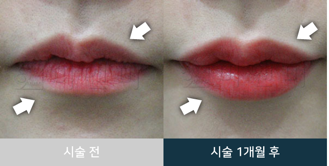 before_Img